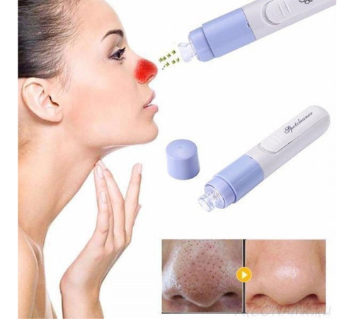 Вакуумний очищувач SPOTCLEANER Face Pore Cleaner вакуумний очищувач пор обличчя UP-37